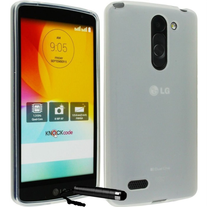 Le-migliori-cover-e-custodie-per-l'LG-K7-su-Amazon-5
